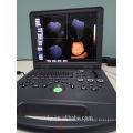 Voller Digital-Farbdoppler-Ultraschall-Laptop-Ultraschallmaschinen-Preis-tragbarer Ultraschall-Scanner 3D